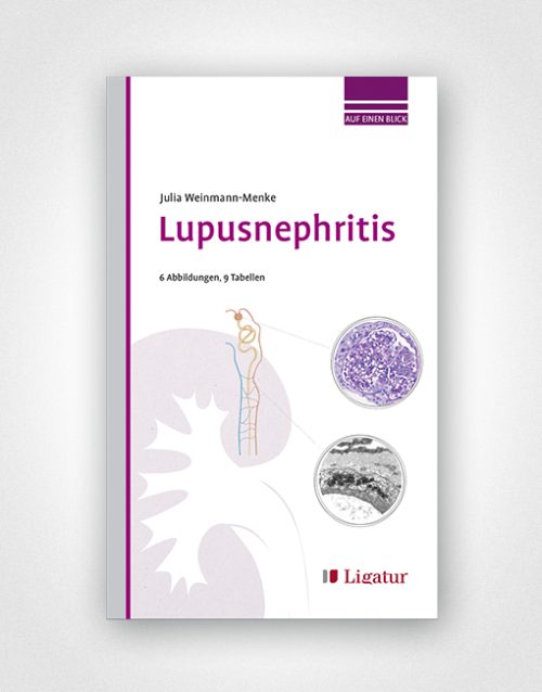 Lupusnephritis